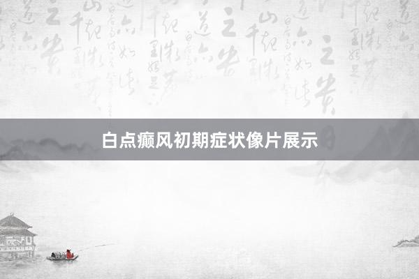 白点癫风初期症状像片展示